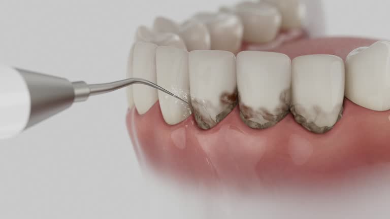 Trusted Tooth Extraction service in Struthers, OH - Dentist Open Now